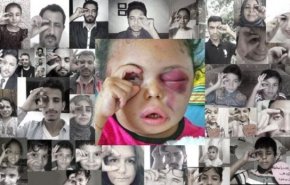 بثینه یمنی دوباره ائتلاف متجاوز را به چالش کشید + فیلم 