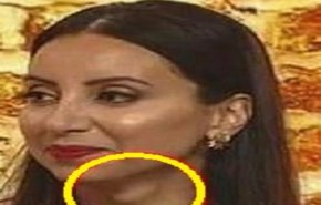 لقاء تلفزيوني يكشف 'كارثة' في رقبة المذيعة