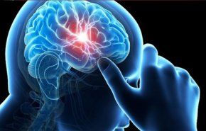 الضوء الأزرق يساعد في علاج ارتجاجات الدماغ!