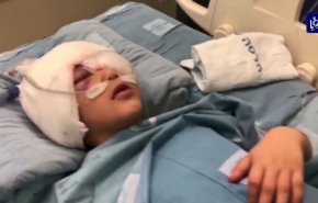 توثيق جريمة الاحتلال بحق الطفل عيسى لرفعها للمحاكم الدولية