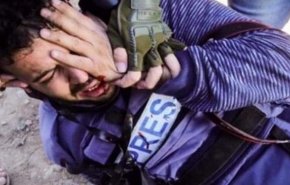نابینا شدن 21 فلسطینی در غزه به دلیل شلیک نظامیان صهیونیست طی 2 سال