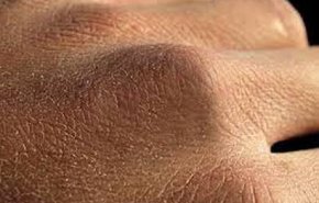 راه های مقابله با خشکی پوست دست در روزهای کرونایی
