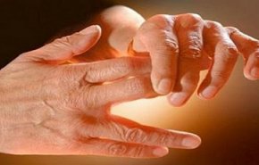 ميزة في اليد تكشف الرجال الأقل عرضة للوفاة بـ'كوفيد-19'
