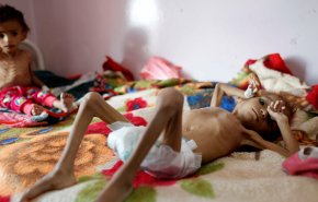 سازمان ملل ائتلاف سعودی را از فهرست ناقضان حقوق کودکان خارج کرد!