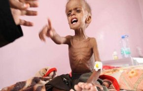صنعاء: سازمان ملل دربرابر گرسنگی و کشتار میلیون‌ها کودک یمنی کور و کر است

