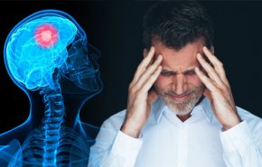 ورم الدماغ عند البالغين..ما هو الاعراض والاسباب؟