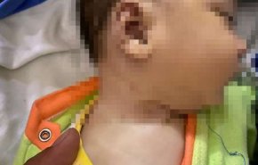 مرگ هولناک نوزاد شیرخواره مصری به دلیل بی مبالاتی والدینش