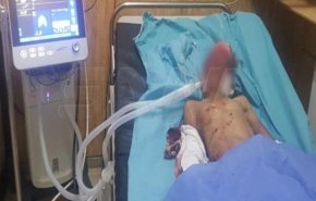 انفجار در سوریه به کشته شدن 2 غیرنظامی و زخمی شدن 6 کودک منجر شد

