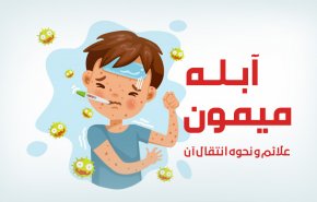 اینفوگرافیک | آبله میمون؛ علایم و نحوه انتقال آن