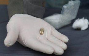 العثور على سن إنسان قديم عاش قبل 1.8 مليون عام