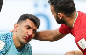 جام جهانی 2022قطر/ بیرانوند به بیمارستان منتفل شد