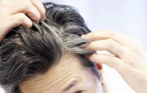 أغذية تعجل بظهور الشيب المبكر