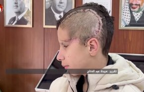 کوچک ترین اسیر فلسطینی که اشغالگران جمجمه اش را خُرد کردند+ فیلم 
