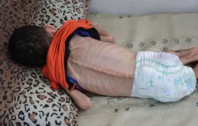 شهادت کودک فلسطینی به خاطر گرسنگی + فیلم 