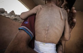 ۶۲۰ فلسطینی به خاطر گرسنگی و نبود دارو  جان باختند/ 69 نفر کودک هستند
