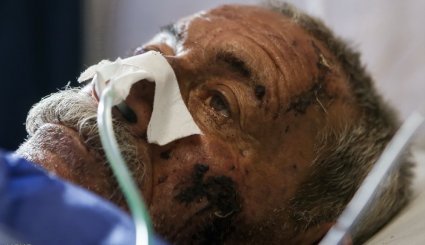 رسیدگی به مصدومان حادثه زلزله کرمانشاه + تصاویر
