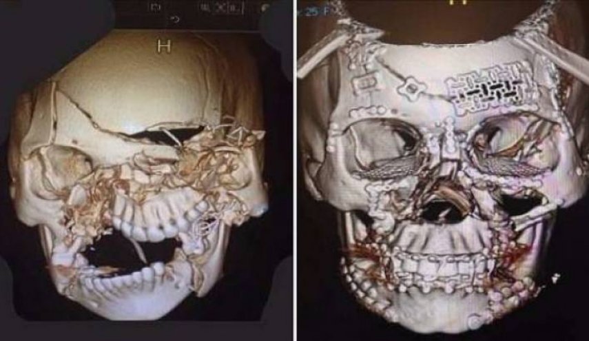 اگر از کمربند ایمنی خودرو استفاده نکنید! 