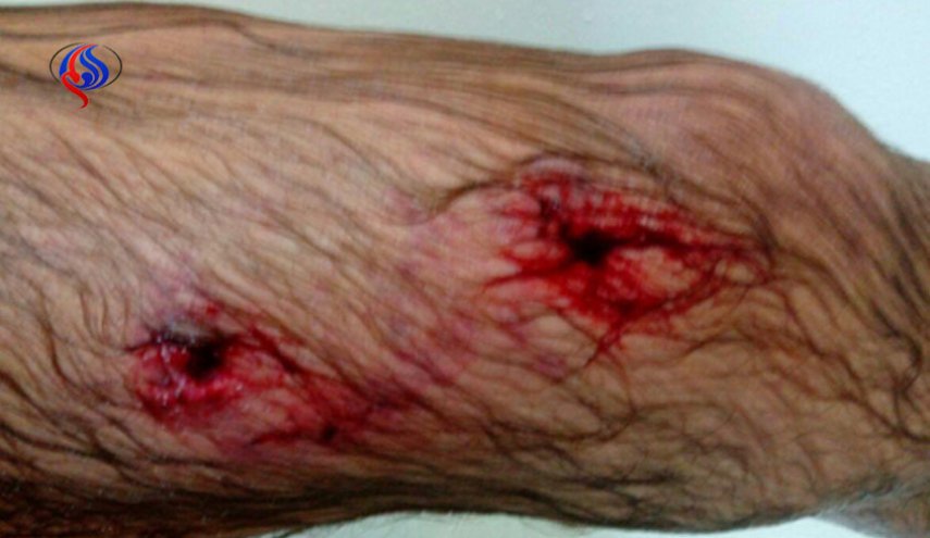 جدال چوپان با خرس وحشی/ سگ های گله ناجی شدند+ تصاویر