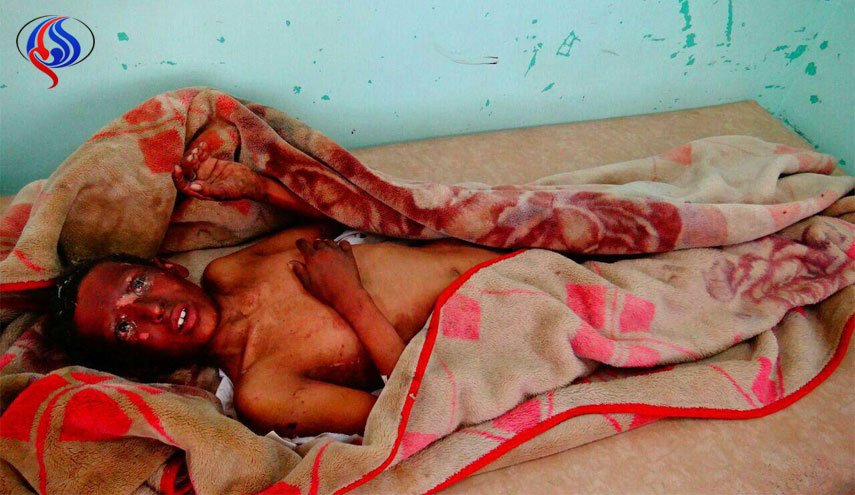 شاهد بالصور.. مجزرة تقشعر لها الابدان في الجوف +18