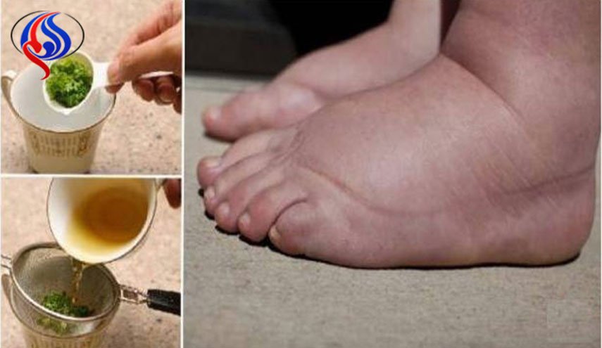 7 أشياء نقوم بها تتسبب باحتباس الماء في الجسم.. هكذا تتخلّصون منها