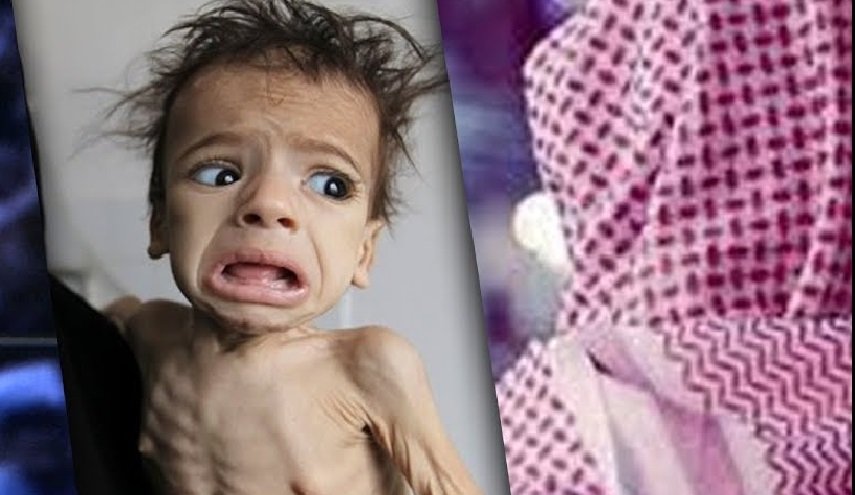 اليمن بلا عُذريّة ومفاتن و3 ملايين للعذراء الأمريكيّة!