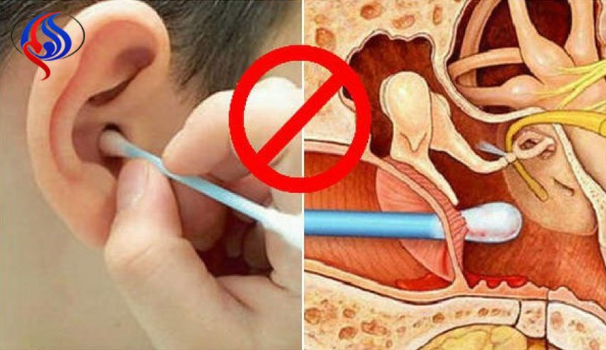 أطباء: أعواد التنظيف القطنية 