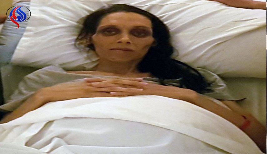 صورة مؤثرة لشابة على فراش الموت... والعائلة تكشف المستور!