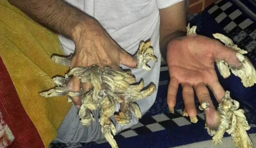 صور: عراقي يتحول إلى 