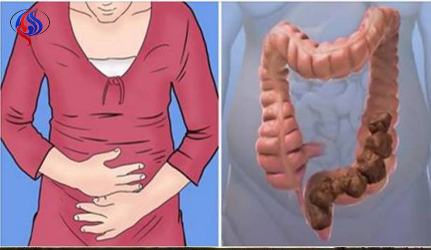 معلومات مهمّة عن الإمساك.. متى تحتاج لاستشارة الطبيب؟