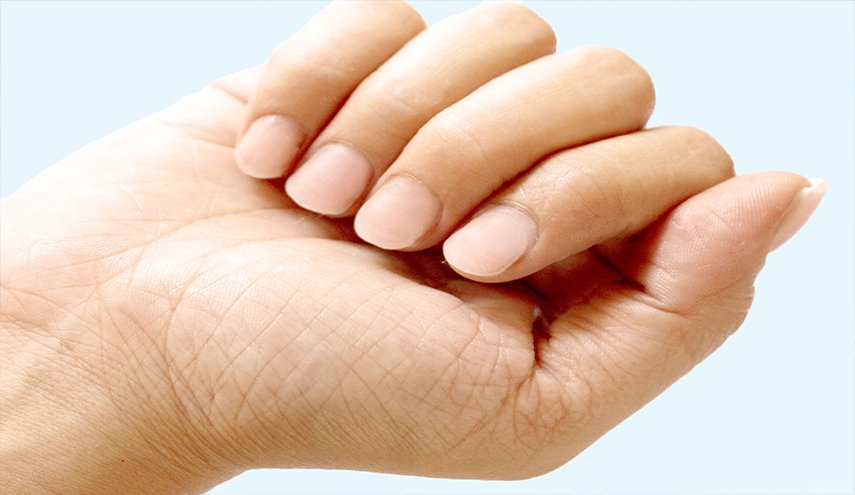 حالة نادرة حيّرت الأطباء... ماذا نما فوق ظفر رجل؟ + صور