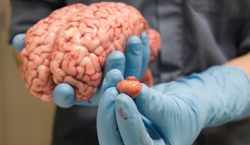 خمس عادات قاتلة لخلايا الدماغ !