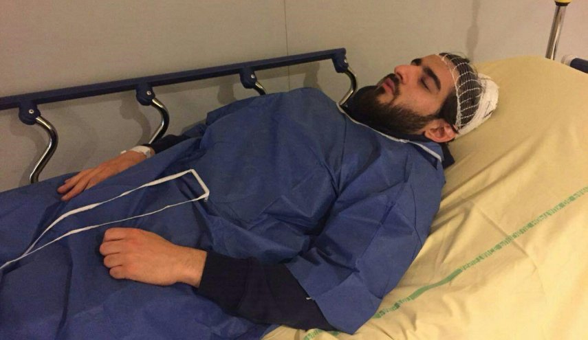 عکس/ تصویربردار خبرگزاری صدا و سیما در فرانسه که بر اثر خشونت پلیس این کشور مجروح شده بود