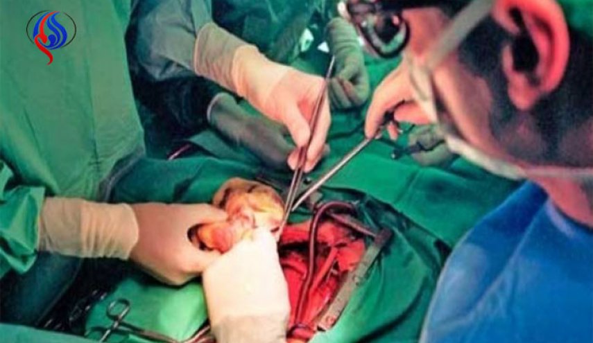 لا داعي للقلق !.. يمكن زراعة الكلية نفسها أكثر من مرة!