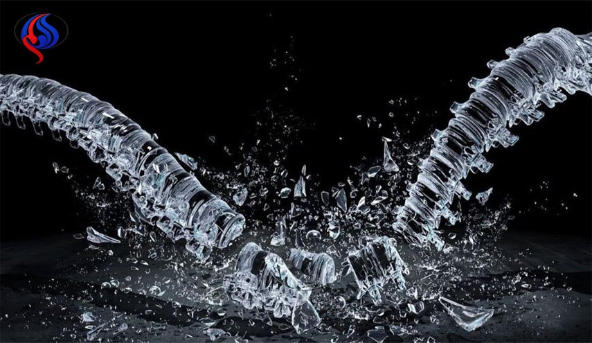 هشاشة العظام، الأسباب والعلاج
