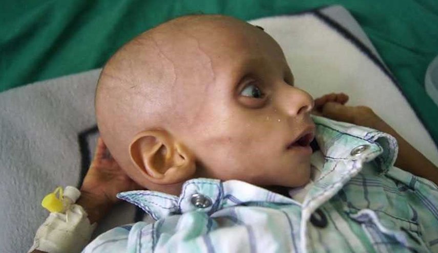 یک مقام سازمان ملل: توافقنامه سوئد حتی به یک کودک یمنی غذا نرسانده است