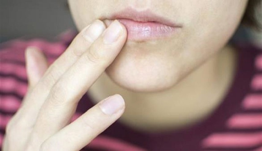 تغير لون الشفاه ينبهك بعوارض مرضية!