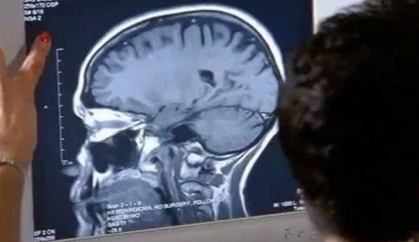 بعد حوالي 30 عاما من تناوله مختلف الأدوية...هذا ما اكتشفه الاطباء في رأسه! 