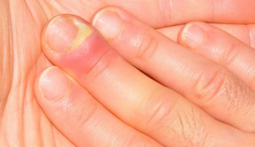 تحذير هام... مخاطر صحية هامة لدى زيارة صالونات العناية بالأظافر!