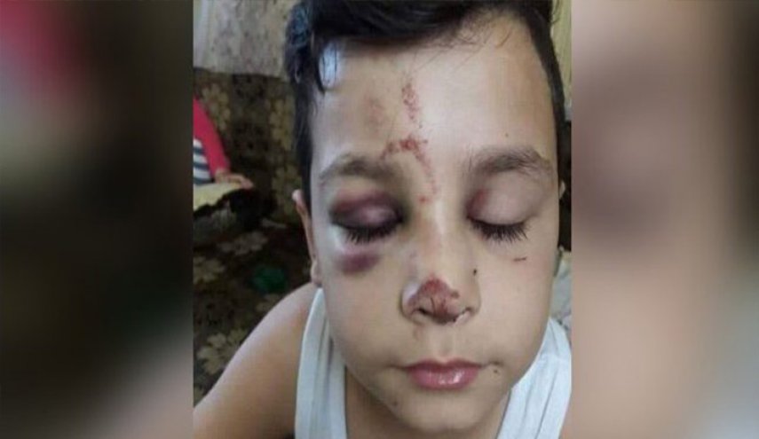 تلميذ يتعرض للضرب بريف اللاذقية..لماذا لم يسعفه احد؟
