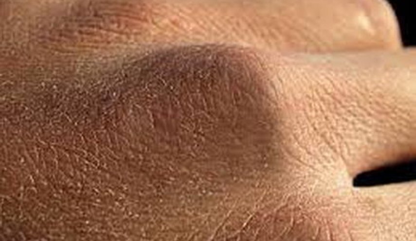 راه های مقابله با خشکی پوست دست در روزهای کرونایی

