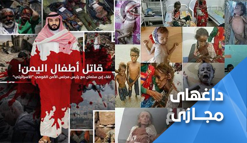 مردم یمن ترسی از گرسنگی ندارند
