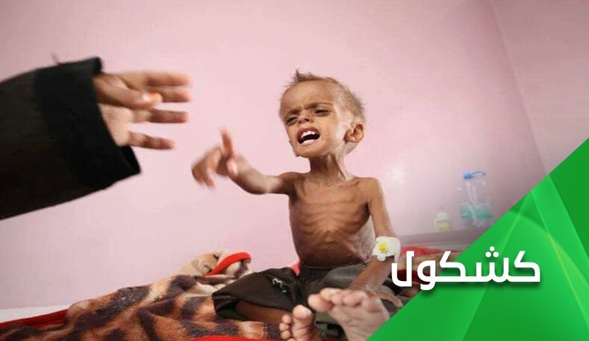 تبانی دبیرکل سازمان ملل؛ تبرئه بن سلمان از کودک کشی در یمن