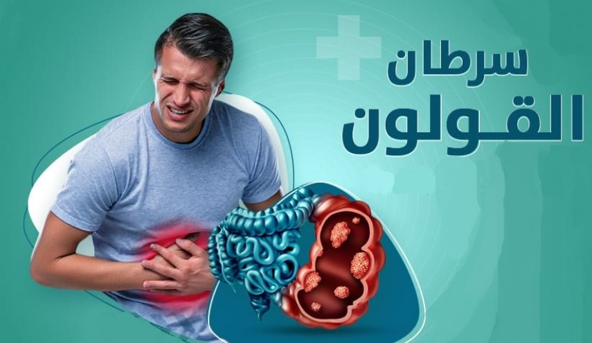 اختبار 
