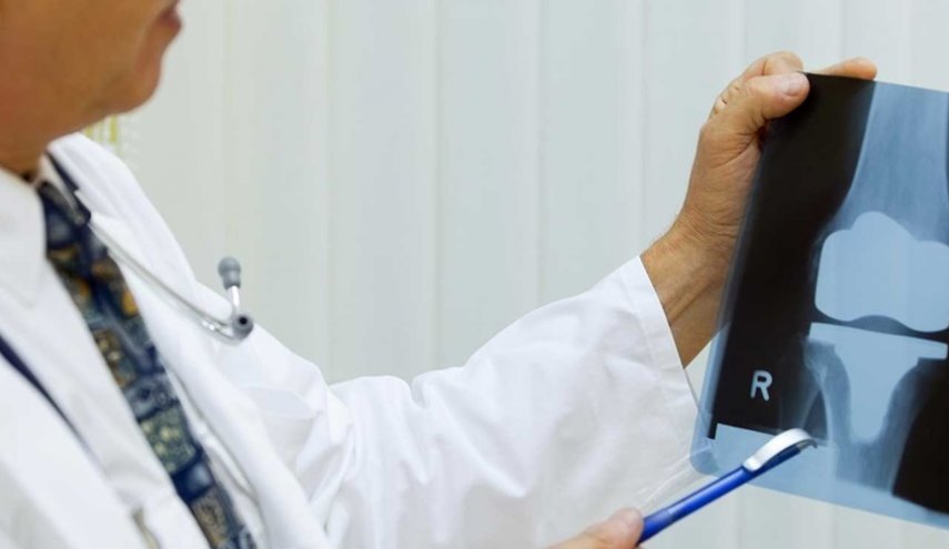 أطباء يحذرون: جراحة استبدال الركبة قبل سن الـ40 تضر أكثر مما تنفع