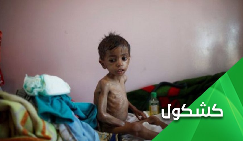 توقع إنقاذ الطفل ريان من البئر.. من ينقذ أطفال اليمن من بئر إبن سلمان وإبن زايد؟