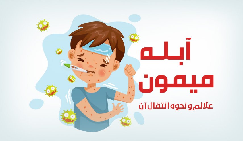 اینفوگرافیک | آبله میمون؛ علایم و نحوه انتقال آن