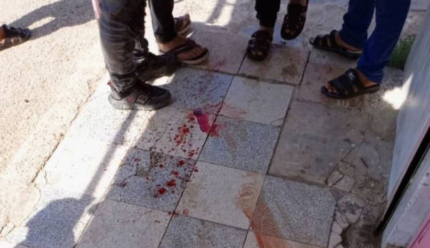 شهيدان وعشرة جرحى باعتداء المسلحين وتركيا على ريفي حلب والحسكة
