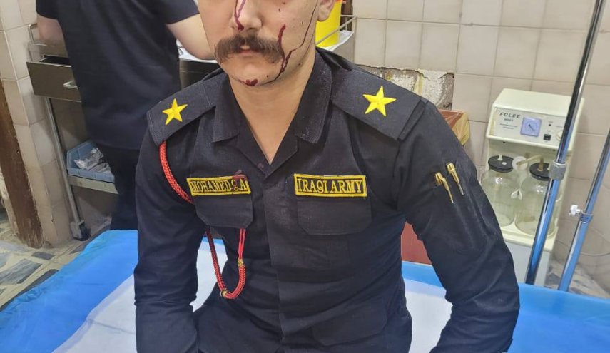 بالصور.. جرحى القوات الامنية نتيجة قصف المنطقة الخضراء