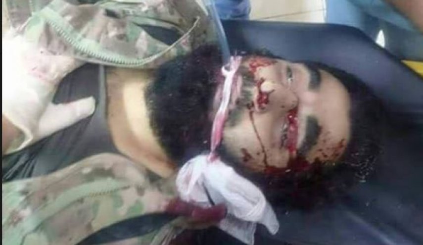 هلاکت تروریست برجسته مورد حمایت ترکیه در حلب