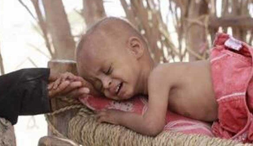 درخواست صنعاء از سازمان ملل برای نجات جان بیش از ۵ هزار بیمار در یمن